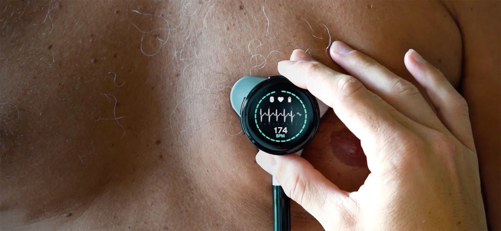 Precision Care for Every Heart